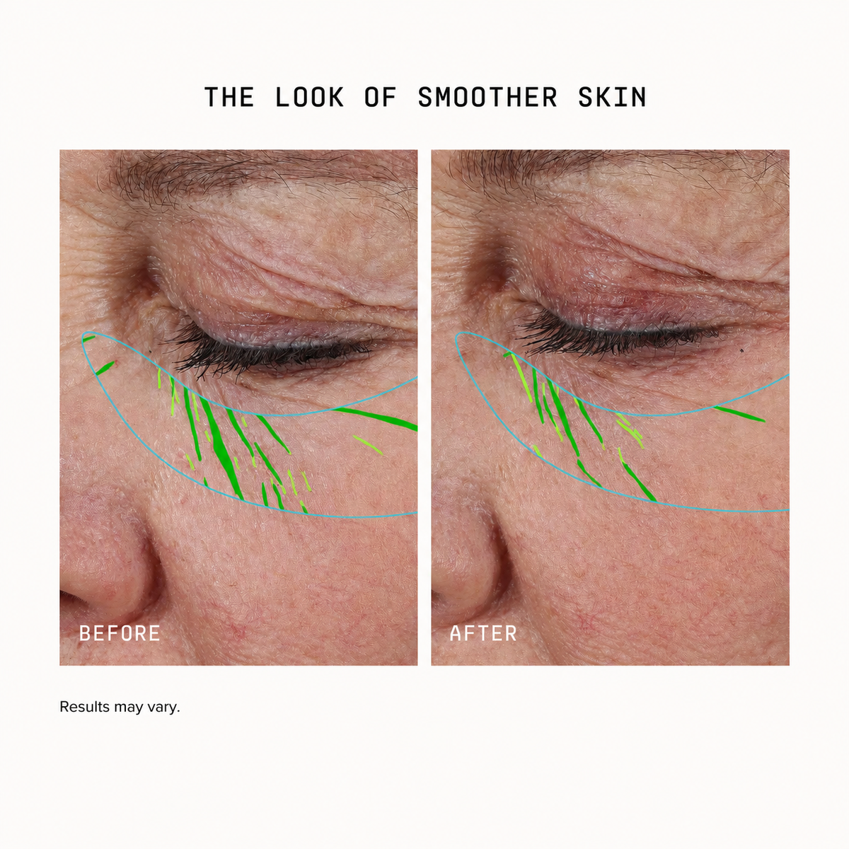 Misspone Growth Factor Serum