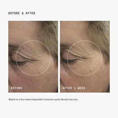 Misspone Brightening Eye Masks