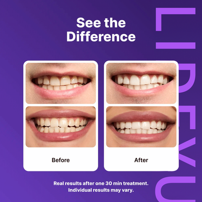 Makelune Dual-Action Whitening Strips — PAP Deep Whitening + Purple Color-Correcting
